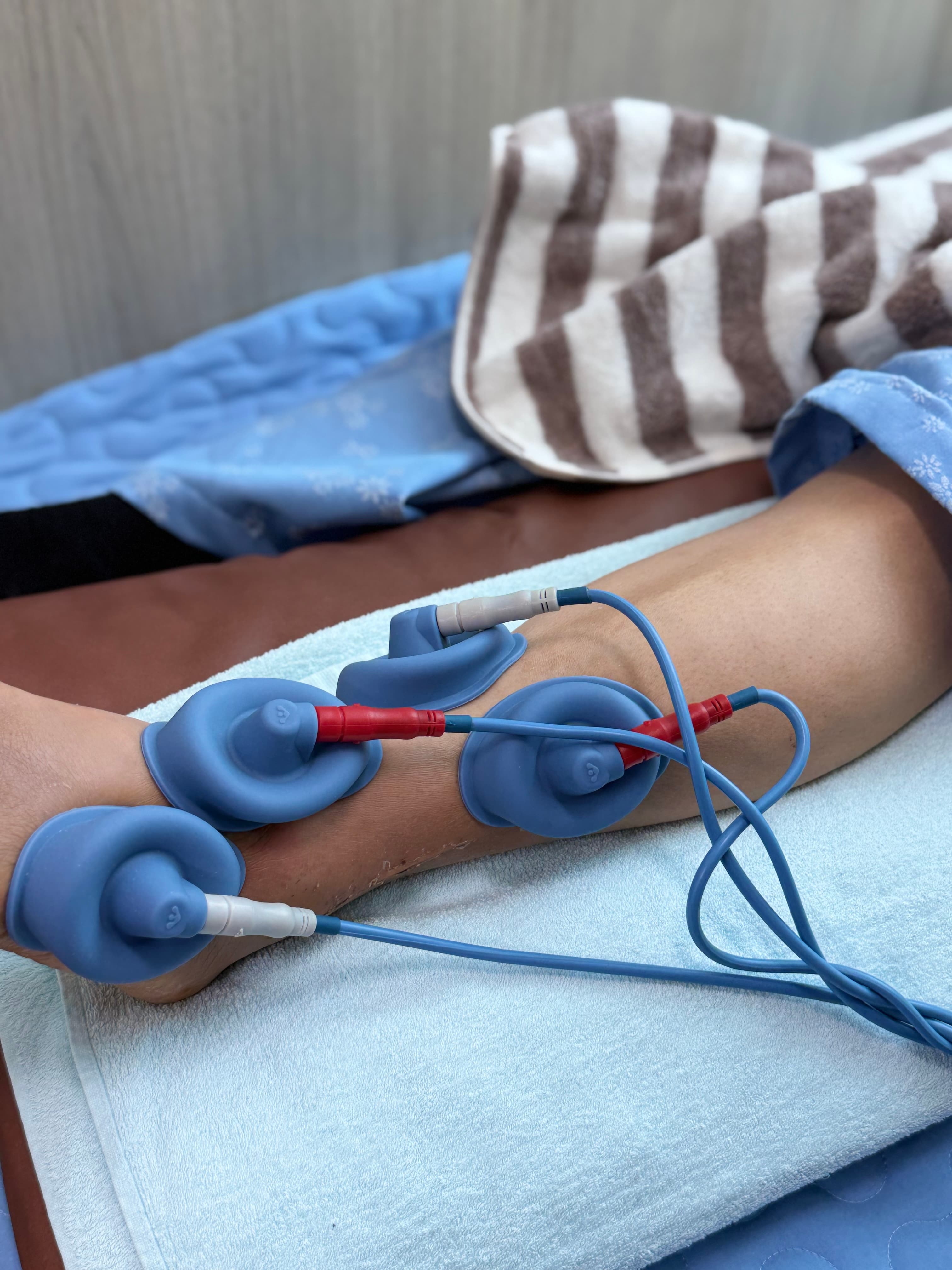 /assets/images/treatments/ICT/ict-1.jpg